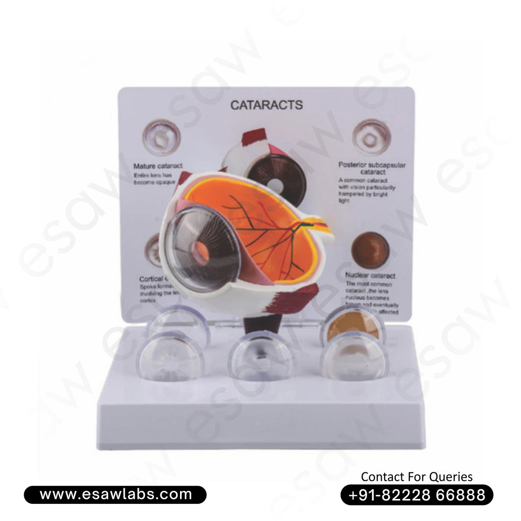 Buy Cataract Eye Model with 5 Interchangeable Lenses | Educational Ophthalmology Model – ESAW India 