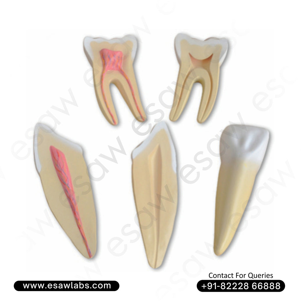 Buy 12x Enlarged Expansion Model of Human Teeth | 3-Piece Dental Anatomy Set – ESAW India