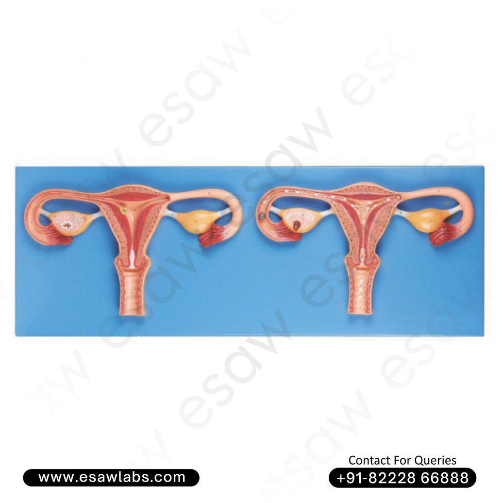 Fertilization Process Simulator Model – High-Quality PVC Human Reproductive System Model