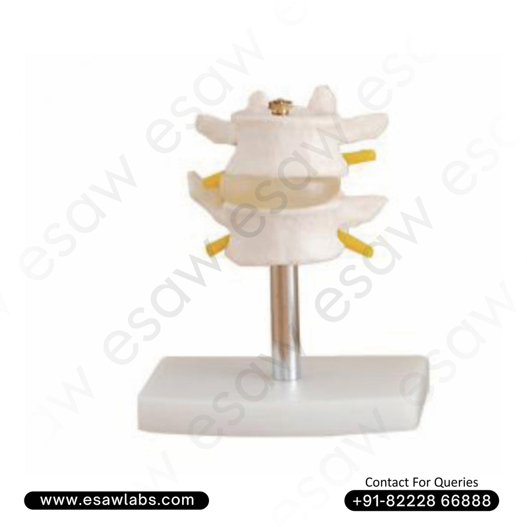 Lumbar Set (2 Pcs) – Life-Size Human Lumbar Vertebrae with Intervertebral Disc and Spinal Cord