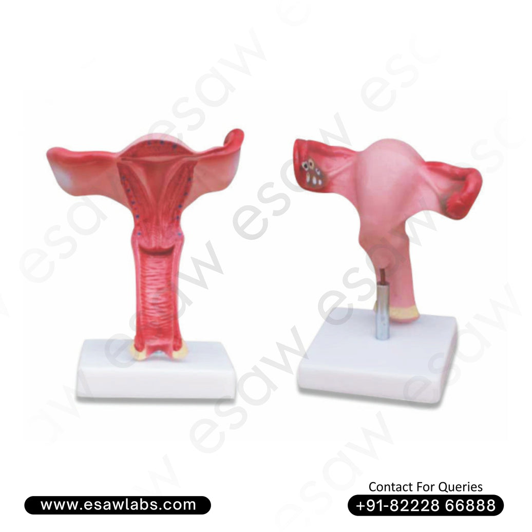 Magnified Uterus Model – Detailed Female Reproductive System Anatomy for Medical Education