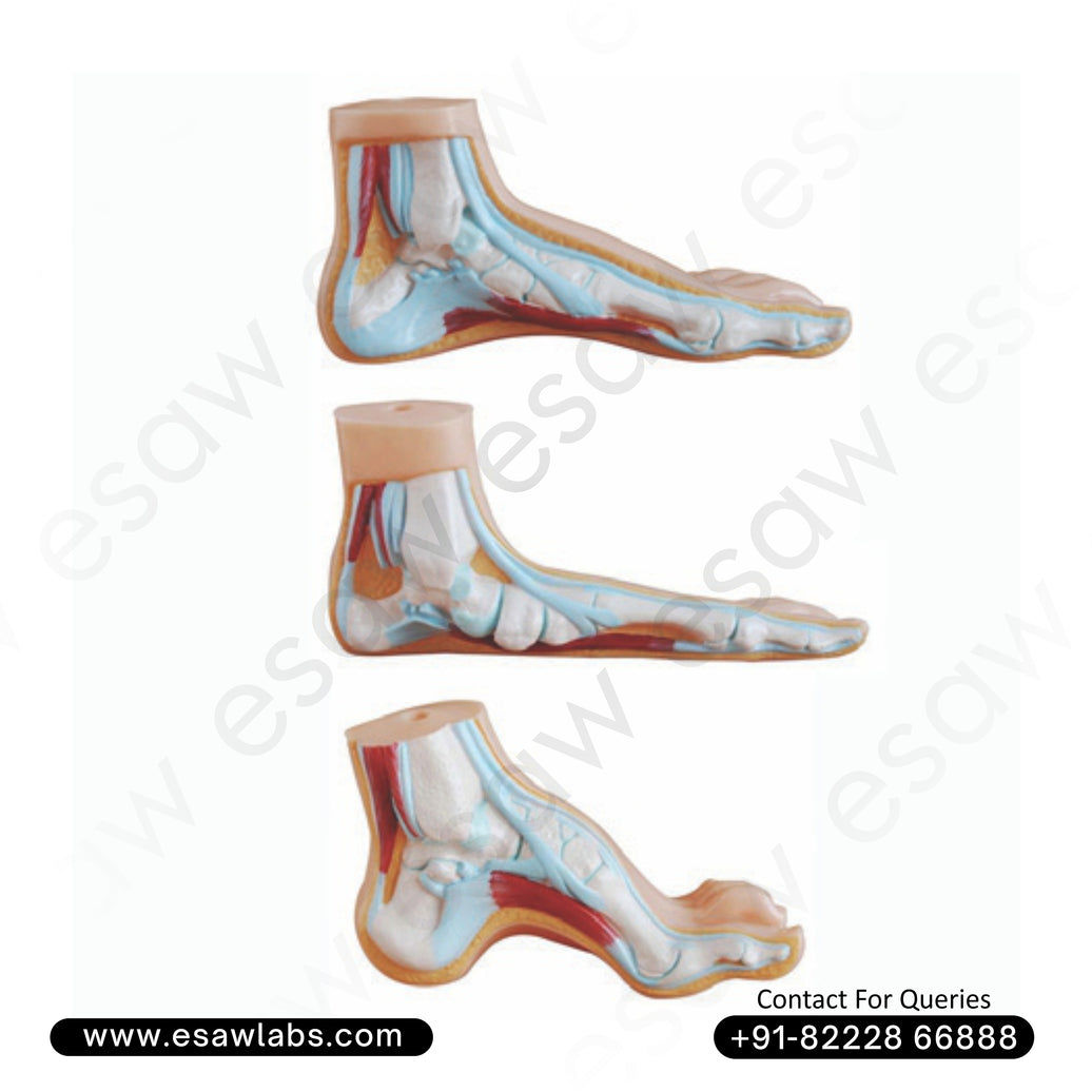 Normal, Flat, and Arched Foot Model – Set of 3 Anatomical Foot Types