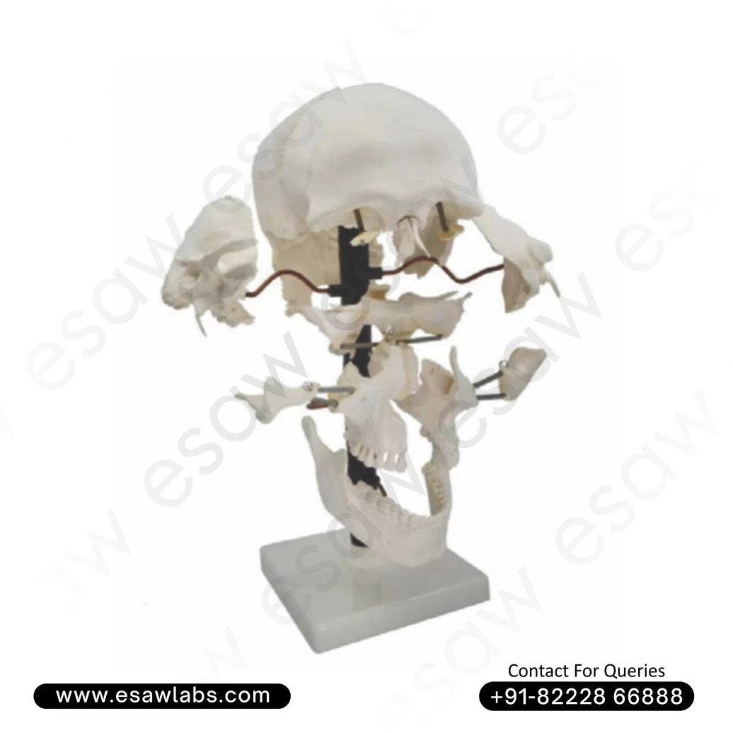 Skull Model Exploded – 22 Parts | Life-Size Anatomical Skull Model – PVC | With Key Card & Manual – By ESAW India