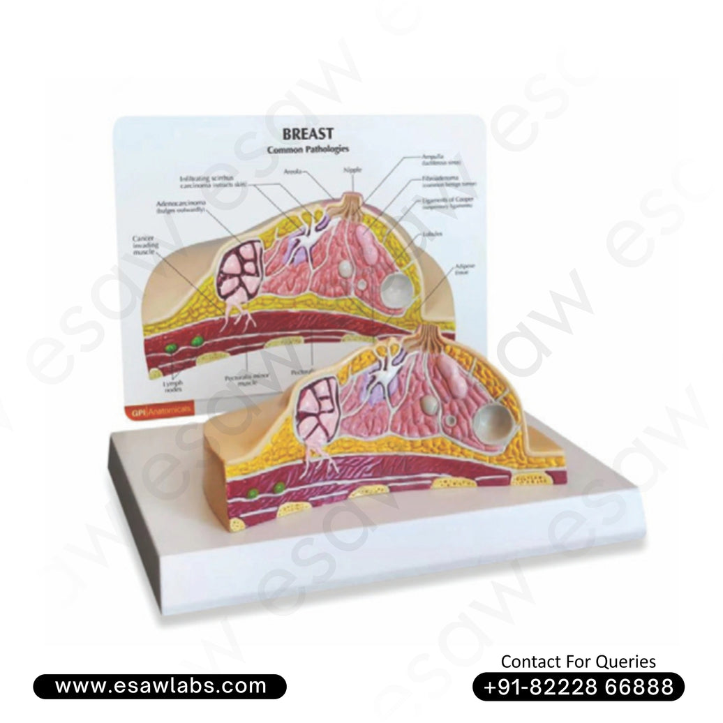 Breast Cross Section Model with Pathologies – ESAW