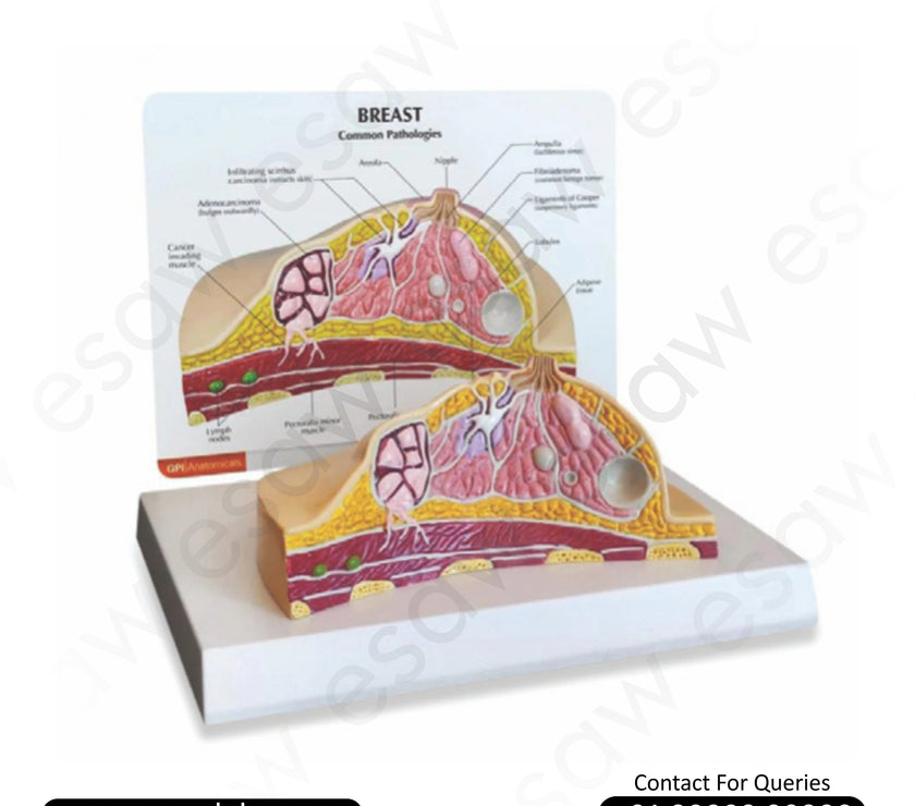 Breast Cross Section Model with Pathologies – ESAW