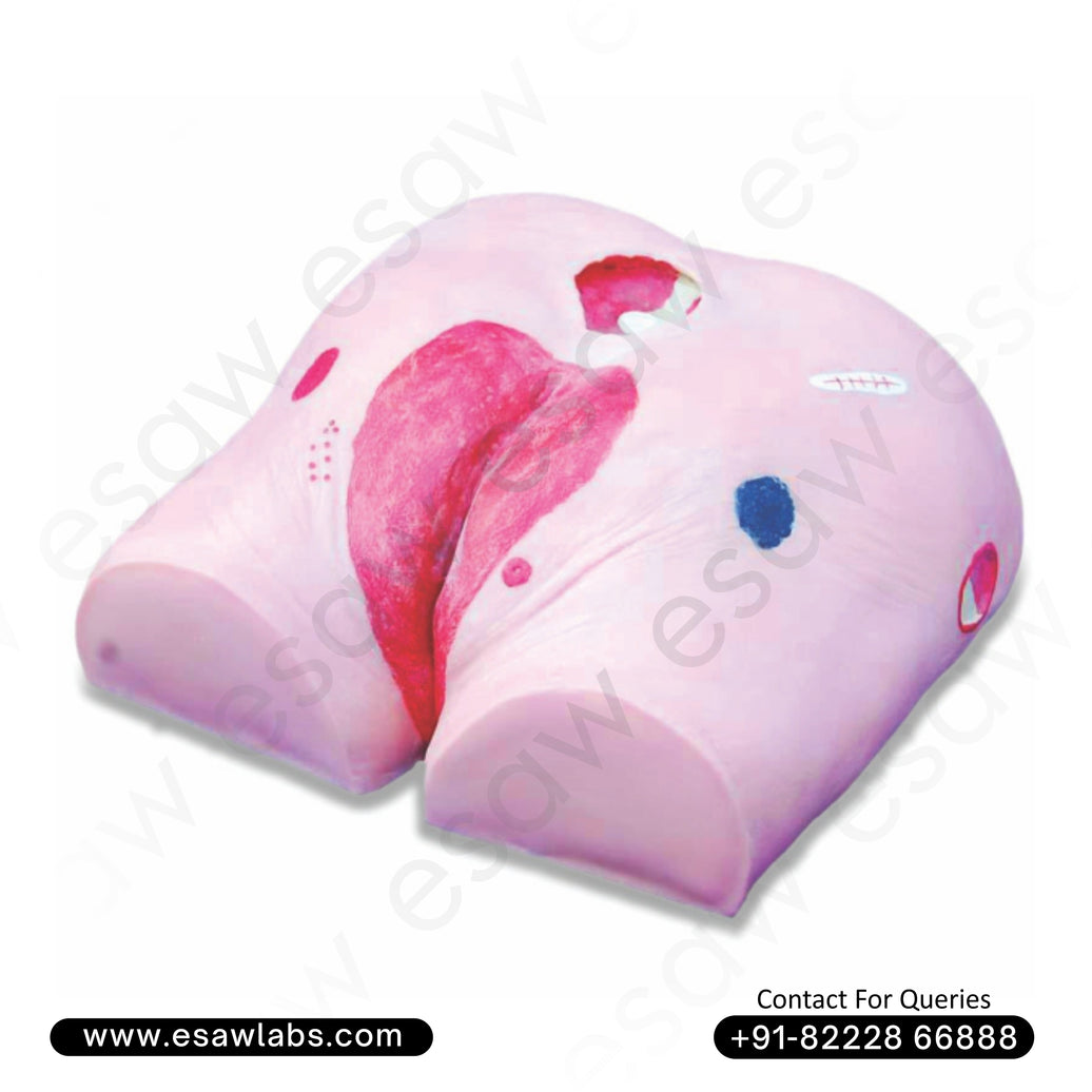 Decubitus Ulcer Care Training Model – 4 Stage Pressure Ulcer Simulator | ESAW India