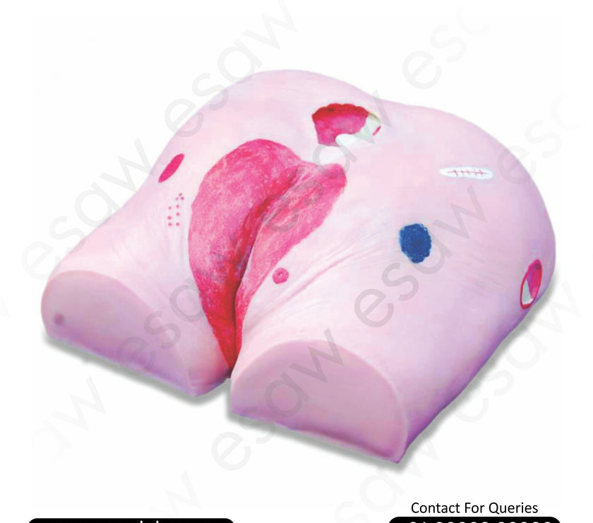 Decubitus Ulcer Care Training Model – 4 Stage Pressure Ulcer Simulator | ESAW India
