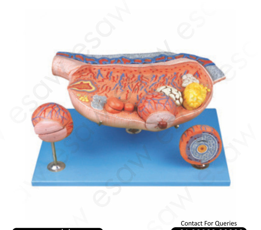 Enlarged Ovary Model – Detailed Human Female Reproductive System Anatomy Model