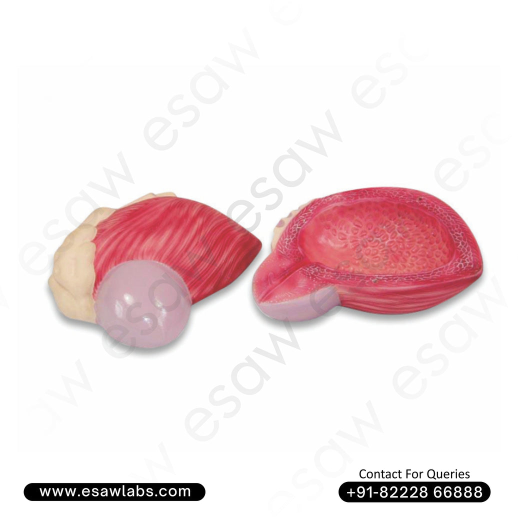 Expansion Model of Urinary Bladder – Male Bladder with Prostate Gland Anatomy for Medical Education