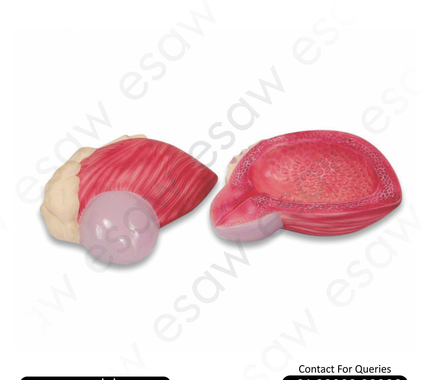 Expansion Model of Urinary Bladder – Male Bladder with Prostate Gland Anatomy for Medical Education