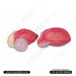 Expansion Model of Urinary Bladder – Male Bladder with Prostate Gland Anatomy for Medical Education