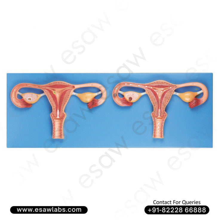 Fertilization Process Simulator Model – High-Quality PVC Human Reproductive System Model