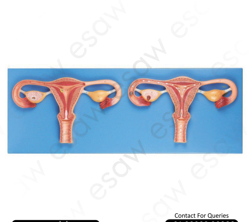 Fertilization Process Simulator Model – High-Quality PVC Human Reproductive System Model