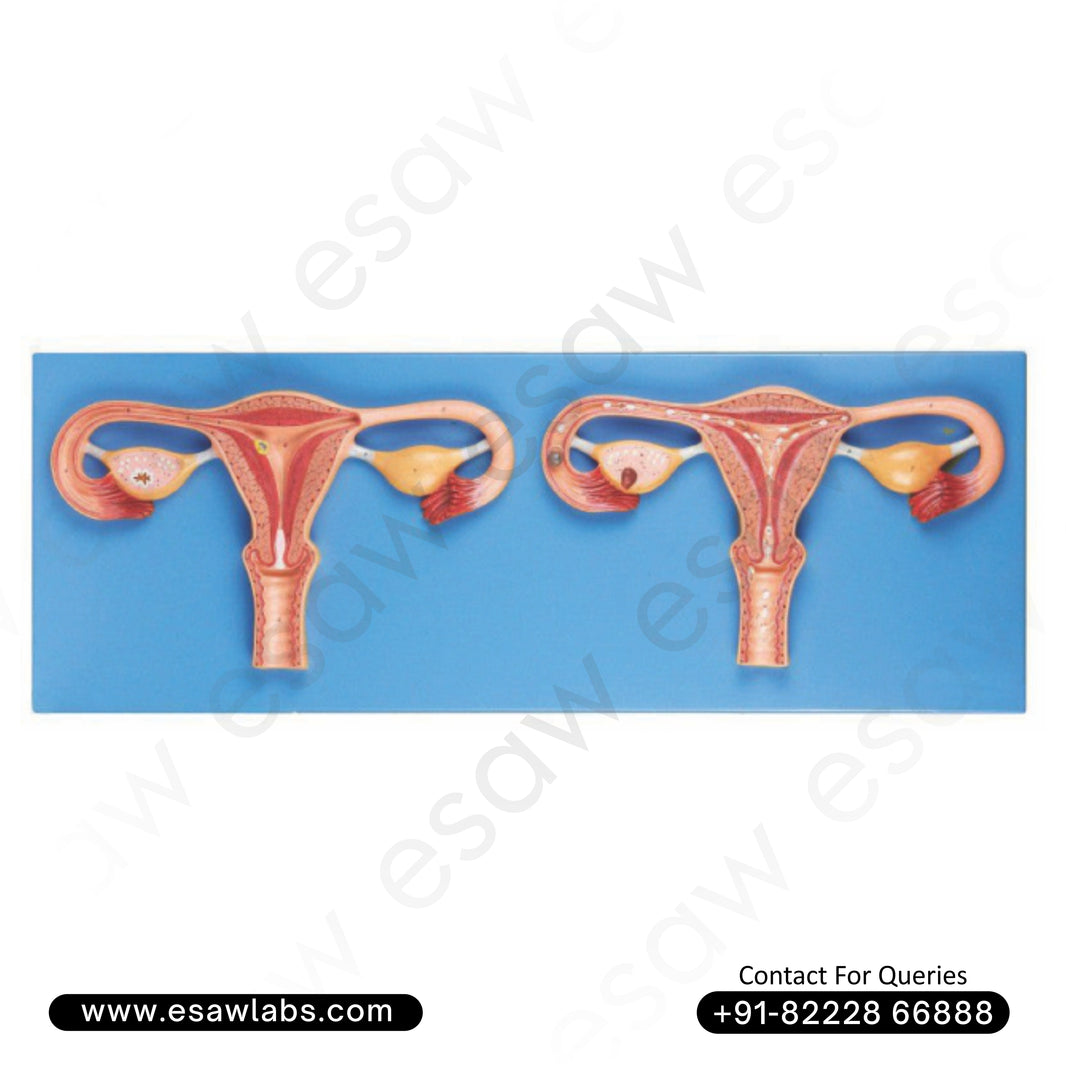 Fertilization Process Simulator Model – High-Quality PVC Human Reproductive System Model