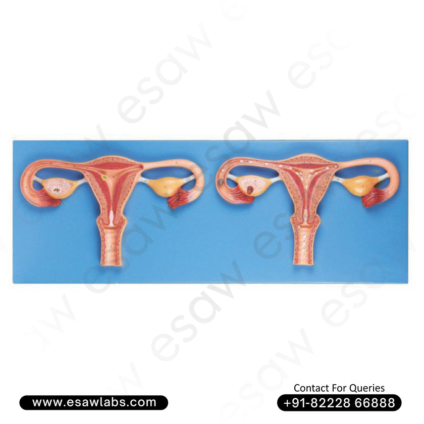 Fertilization Process Simulator Model – High-Quality PVC Human Reproductive System Model