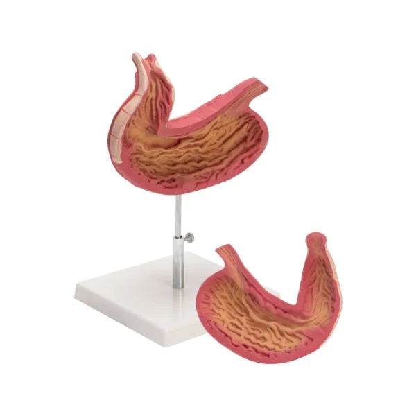 HUMAN STOMACH