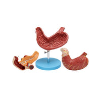 Buy Human Stomach, Pancreas & Duodenum Model – Anatomical Teaching Aid for Labs
