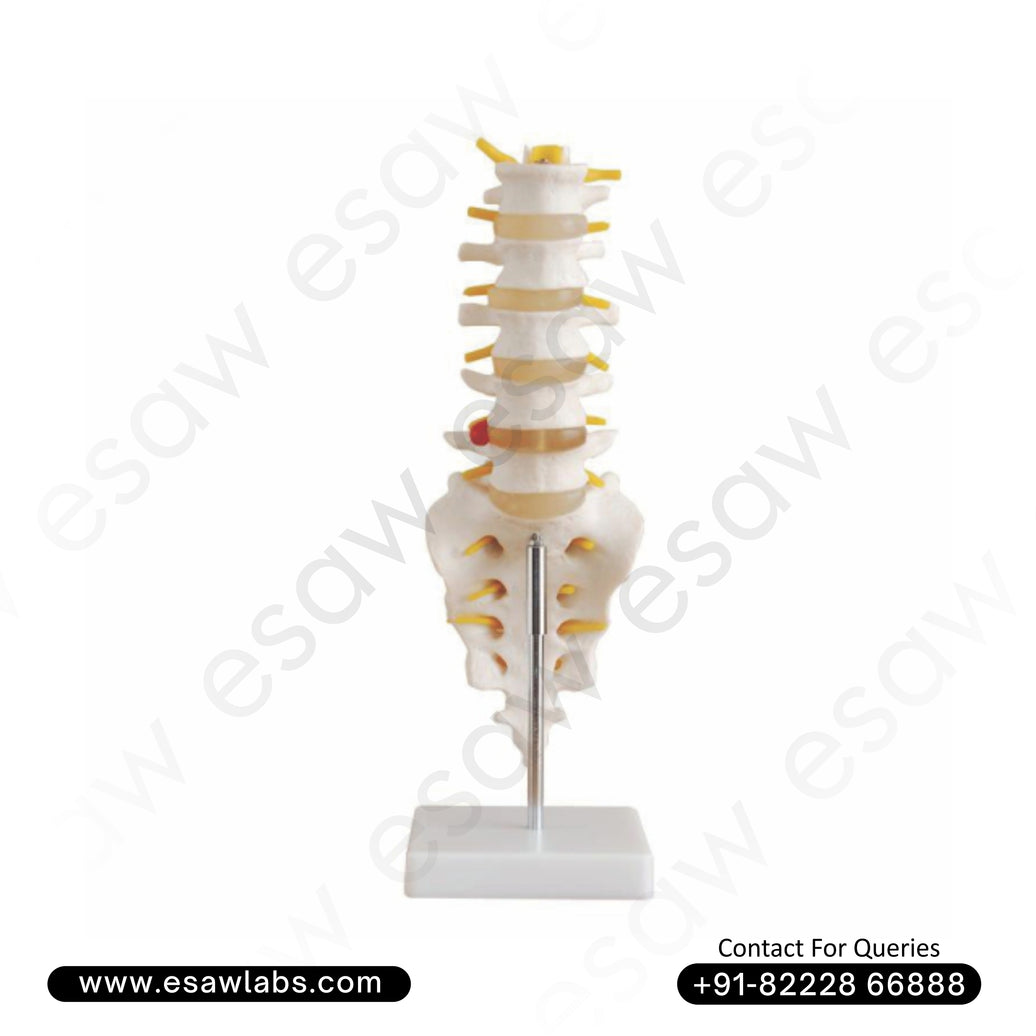Life-Size Lumbar Vertebrae with Sacrum, Coccyx & Herniated Disc Model Spinal Anatomy Teaching Model