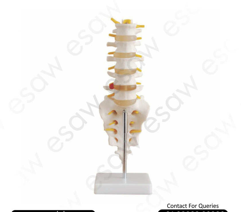 Life-Size Lumbar Vertebrae with Sacrum, Coccyx & Herniated Disc Model Spinal Anatomy Teaching Model