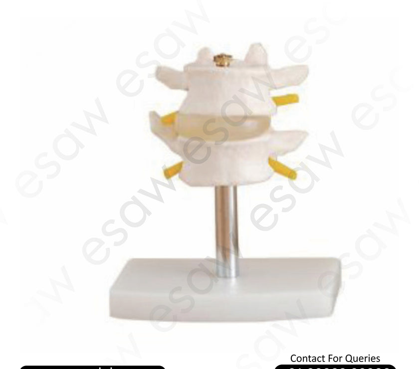 Lumbar Set (2 Pcs) – Life-Size Human Lumbar Vertebrae with Intervertebral Disc and Spinal Cord