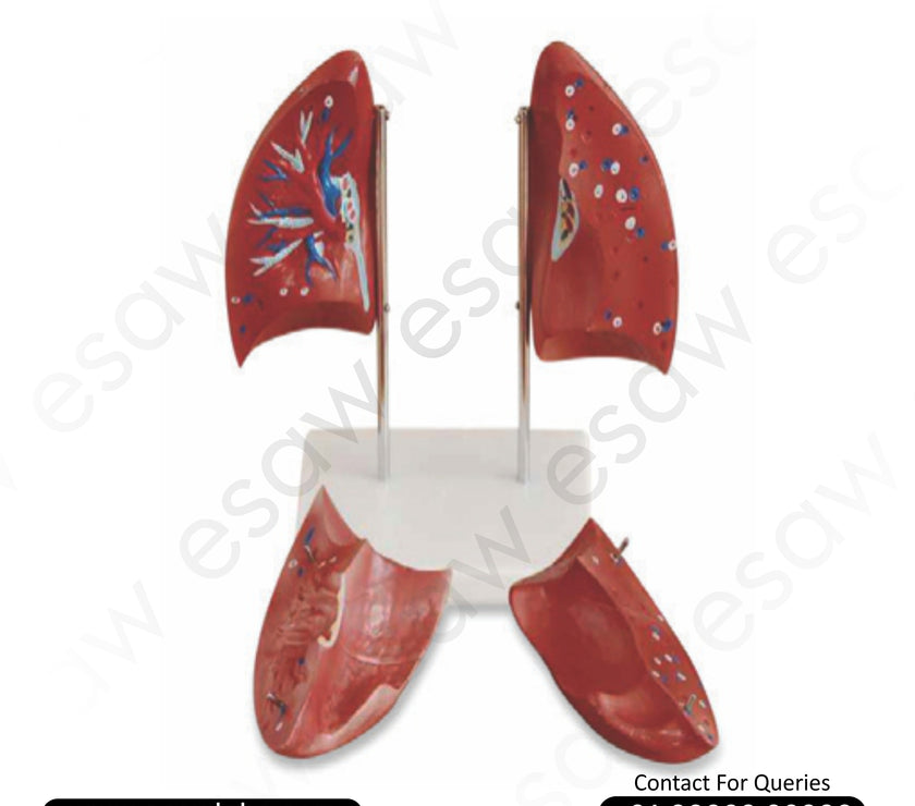 🫁 Buy Life-Size Human Lung Model – 4-Part Dissectible Anatomy Model | ESAW India