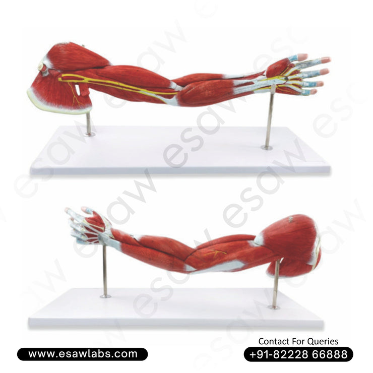 Muscle of Human Arm Model – 7 Parts | Life-Size Right Arm Anatomy with Muscles, Nerves &amp; Vessels | Buy Online from ESAW India