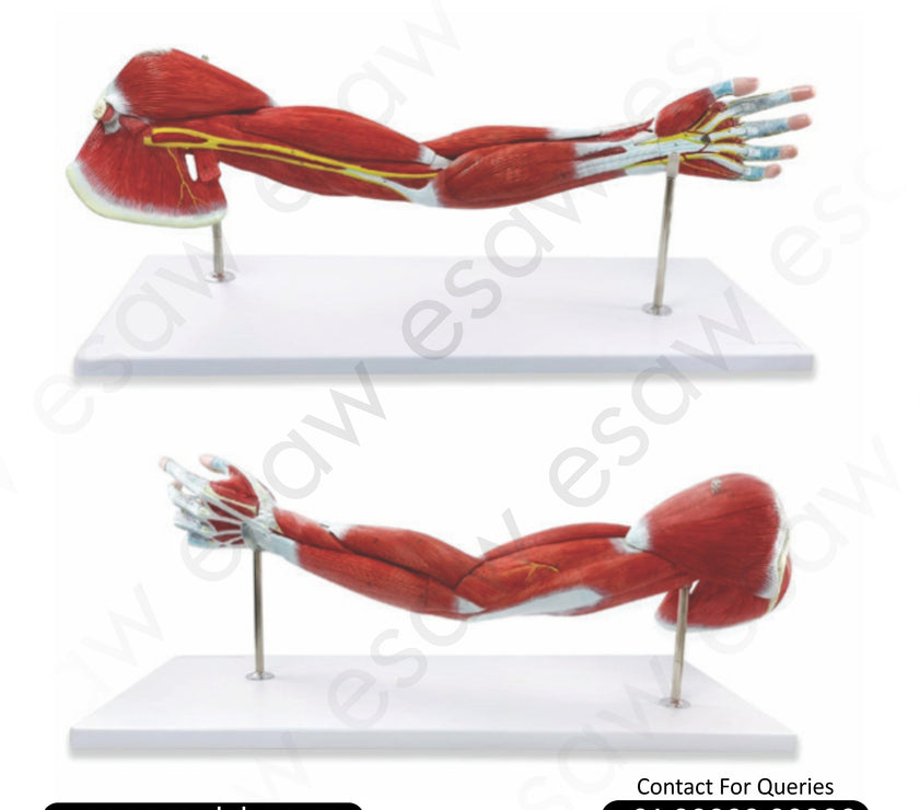 Muscle of Human Arm Model – 7 Parts | Life-Size Right Arm Anatomy with Muscles, Nerves &amp; Vessels | Buy Online from ESAW India
