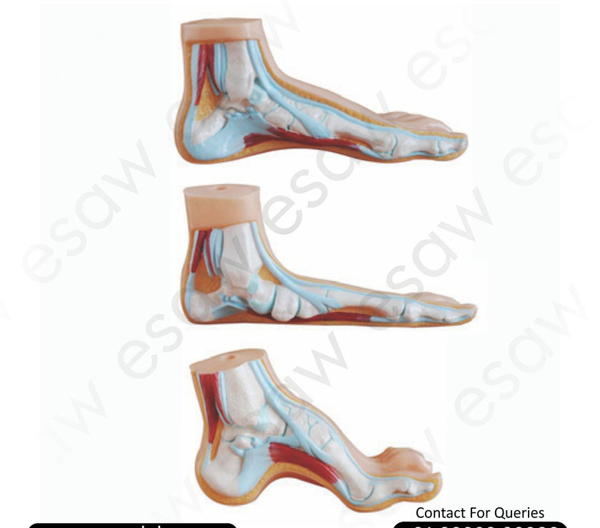 Normal, Flat, and Arched Foot Model – Set of 3 Anatomical Foot Types