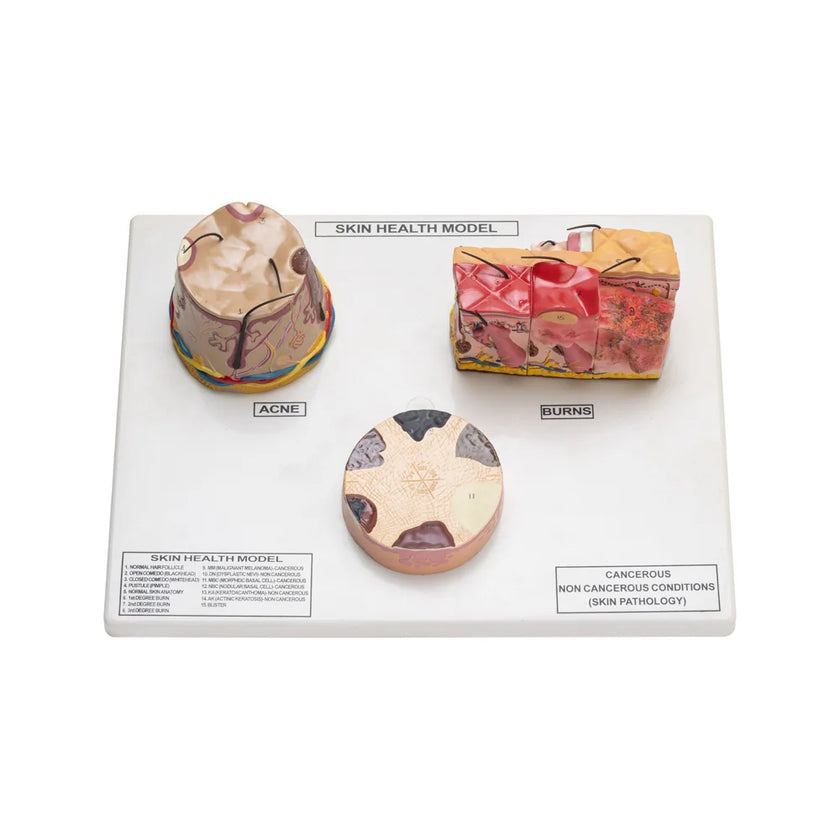 Skin Injury Models Buy Skin Cancer Acne Burn Model – ESAW Dermatology Educational Tool fo