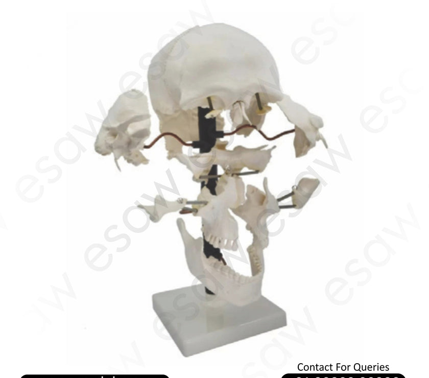 Skull Model Exploded – 22 Parts  | Life-Size Anatomical Skull Model – PVC | With Key Card &amp; Manual – By ESAW India