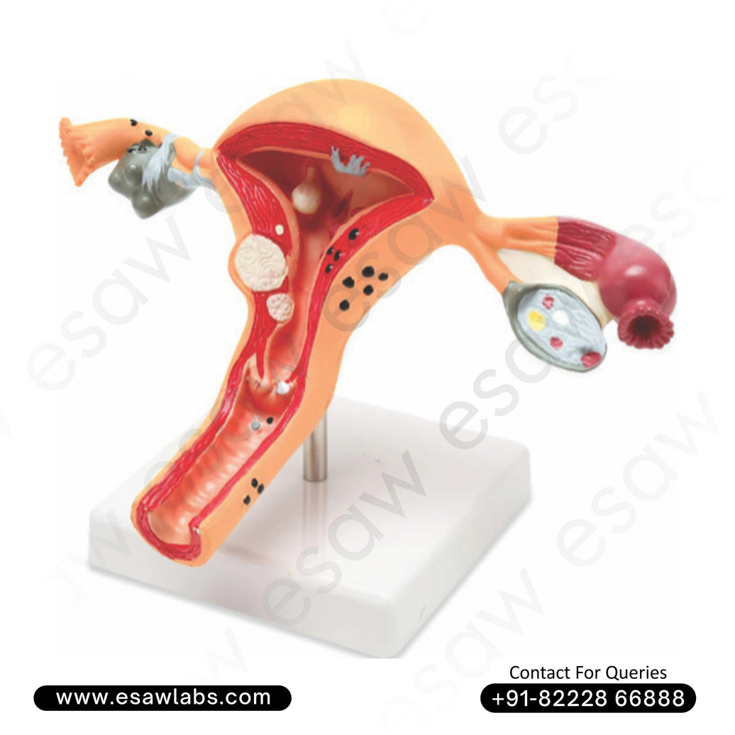 Uterus and Ovary Anatomy Model with Common Pathologies – Educational Female Reproductive Disease Model